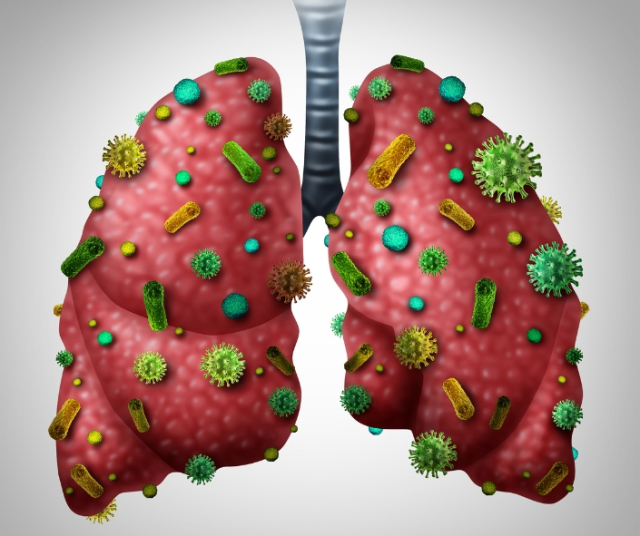 Bronchitis: What it is. treatments and causes 