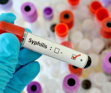 ¿Qué es la Sífilis? - Problemas de salud pública