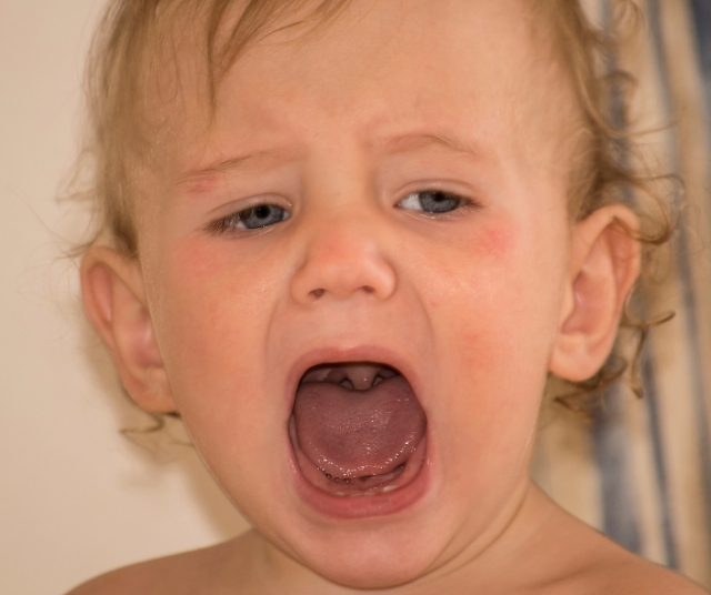 Laringomalacia: Una afección común en los bebés