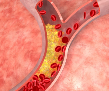 Guía completa sobre el colesterol: Tipos, causas y tratamiento eficaz para el control