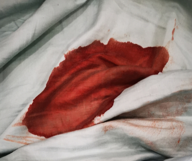 Comment enlever les taches de sang sur les vêtements ?