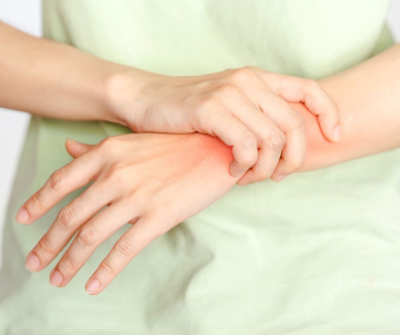 ¿Qué es la artritis?